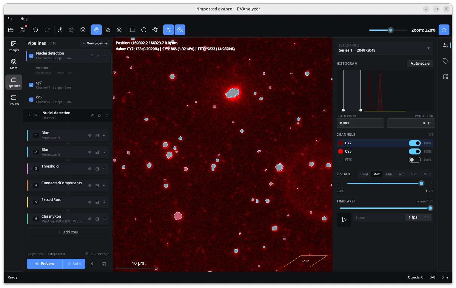 The same zoomed-in pipeline preview and segmentation overlays in dark mode